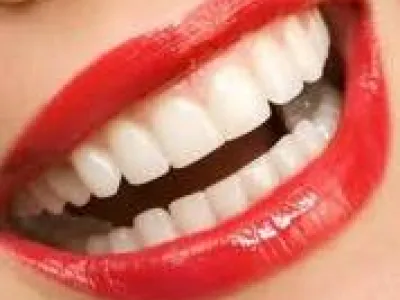Pack 0 peroxyde « open business » (50 Gel + 1 nuan